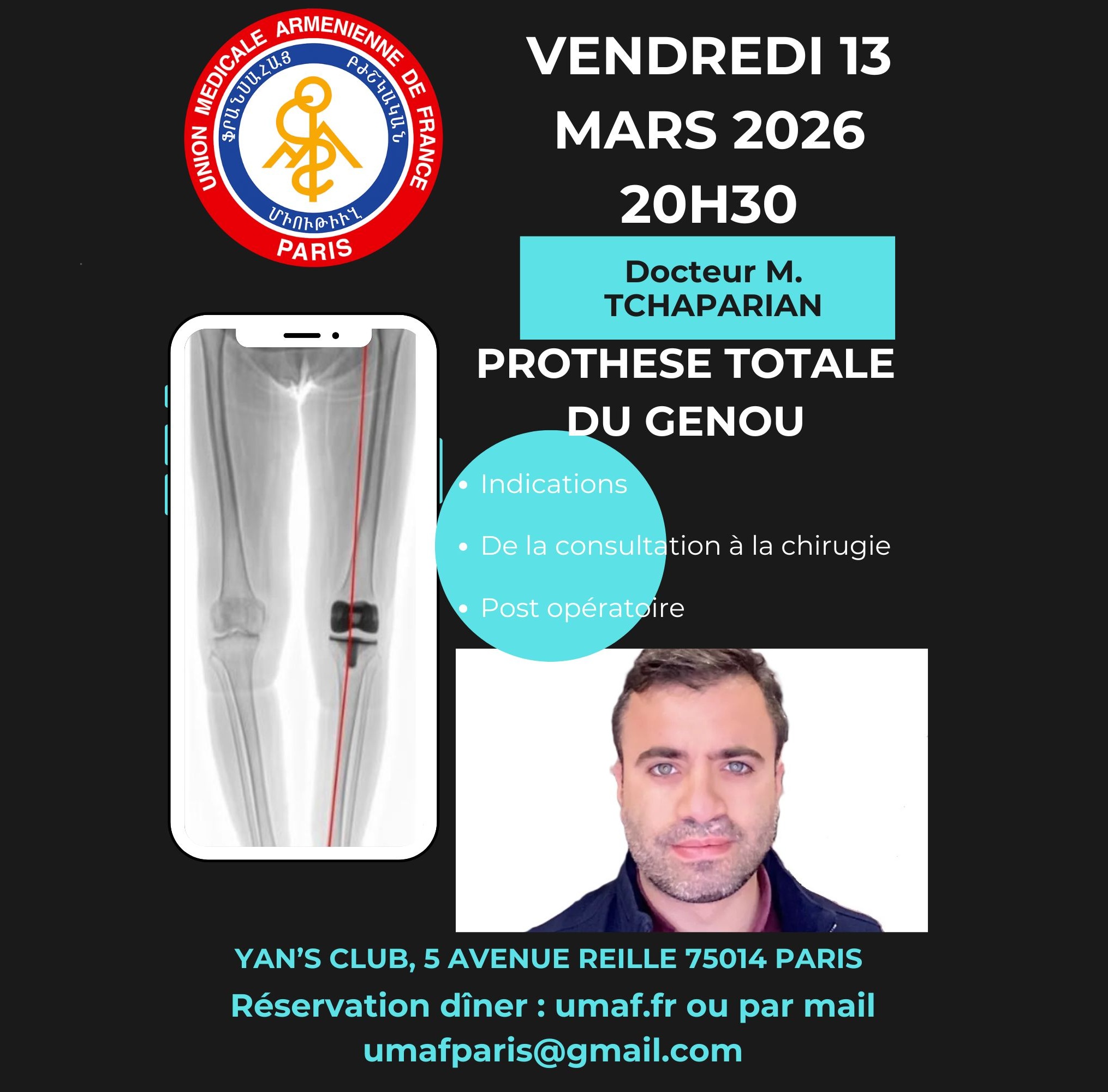 Lire la suite à propos de l’article Vendredi 13 mars 2026 20h30 : Prothèse totale du genou